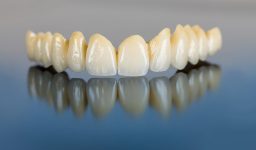 Who Needs Dental Bridges?