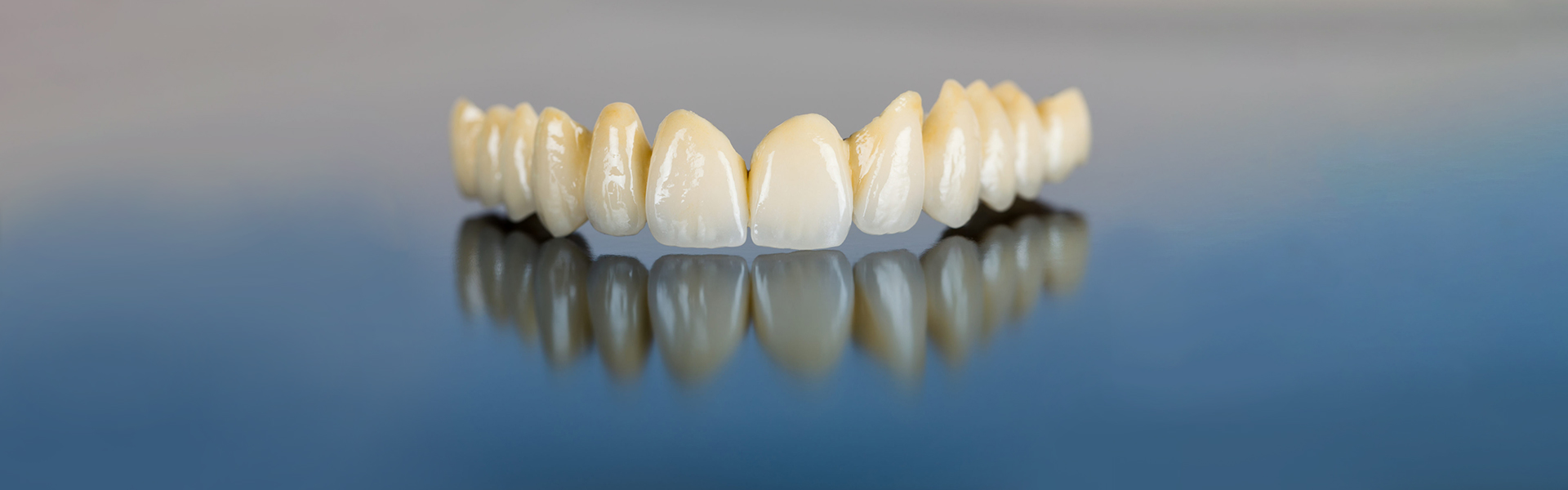 Who Needs Dental Bridges?